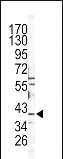 Invitrogen Cathepsin B Polyclonal Antibody 400 μL; Unconjugated:Antibodies,