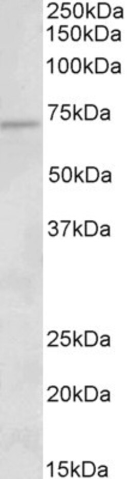Invitrogen ACADVL Polyclonal Antibody 100 &mu;g; Unconjugated:Antibodies,