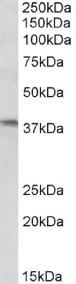 Invitrogen AIM2 Polyclonal Antibody 100 &mu;g; Unconjugated:Antibodies,