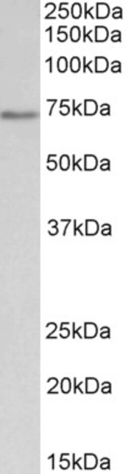 Invitrogen CDC6 Polyclonal Antibody 100 &mu;g; Unconjugated:Antibodies,