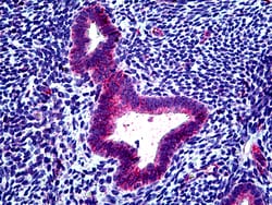 Invitrogen CLCN2 Polyclonal Antibody 100 μg; Unconjugated:Antibodies,