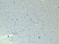 Invitrogen CLCN2 Polyclonal Antibody 100 μg; Unconjugated:Antibodies,