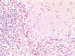 Invitrogen Oct-2 Polyclonal Antibody 100 &mu;g; Unconjugated:Antibodies,