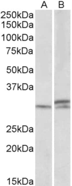 Invitrogen HOXA9 Polyclonal Antibody 100 &mu;g | Buy Online | Invitrogen&trade; | Fisher Scientific