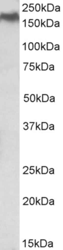 Invitrogen NPC1 Polyclonal Antibody 100 &mu;g; Unconjugated:Antibodies,