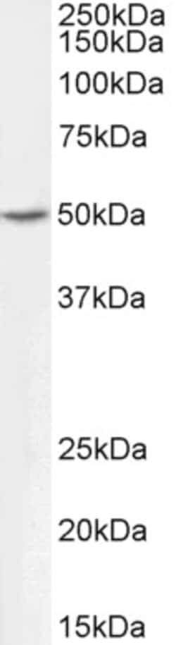 Invitrogen ALDH9A1 Polyclonal Antibody, Biotin 100 &mu;g; Biotin:Antibodies,