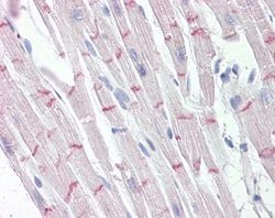 Invitrogen Desmoplakin Polyclonal Antibody 100 &mu;g; Unconjugated:Antibodies,