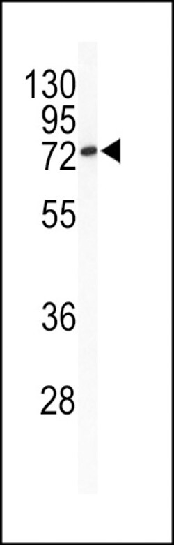 Invitrogen BCL6 Polyclonal Antibody 400 &mu;L; Unconjugated:Antibodies,