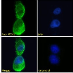 Invitrogen Ataxin 2 Polyclonal Antibody 100 &mu;g; Unconjugated:Antibodies,