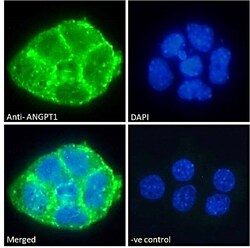 Invitrogen Angiopoietin 1 Polyclonal Antibody 100 μg; Unconjugated:Antibodies,