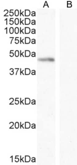 Invitrogen Angiopoietin 1 Polyclonal Antibody 100 μg; Unconjugated:Antibodies,