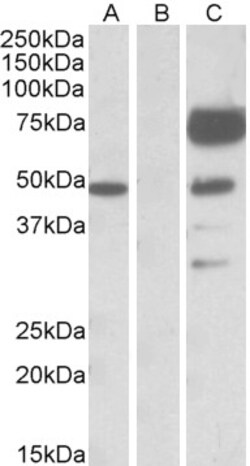 Invitrogen Angiopoietin 1 Polyclonal Antibody 100 μg; Unconjugated:Antibodies,