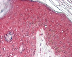 Invitrogen PSMB4 Polyclonal Antibody 100 &mu;g; Unconjugated:Antibodies,