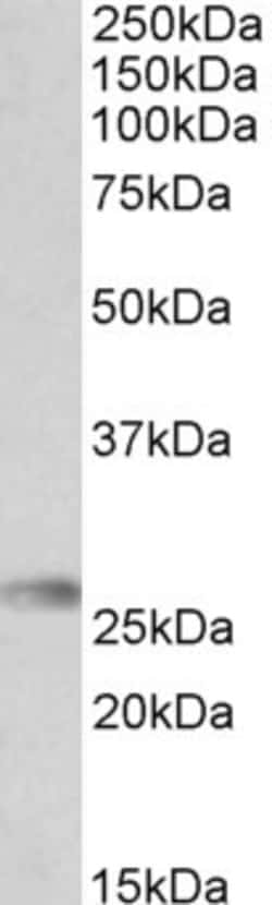 Invitrogen HLA-DQA2 Polyclonal Antibody 100 &mu;g | Buy Online | Invitrogen&trade; | Fisher Scientific