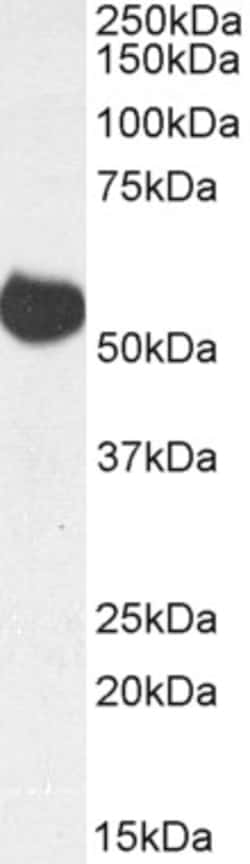 Invitrogen ALDH5A1 Polyclonal Antibody, Biotin 100 &mu;g; Biotin:Antibodies,