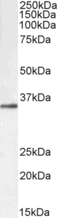 Invitrogen GNB3/GNB4 Polyclonal Antibody, Biotin 100 &mu;g | Buy Online | Invitrogen&trade; | Fisher Scientific