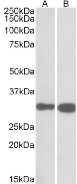 Invitrogen PDXP Polyclonal Antibody 100 &mu;g; Unconjugated:Antibodies,