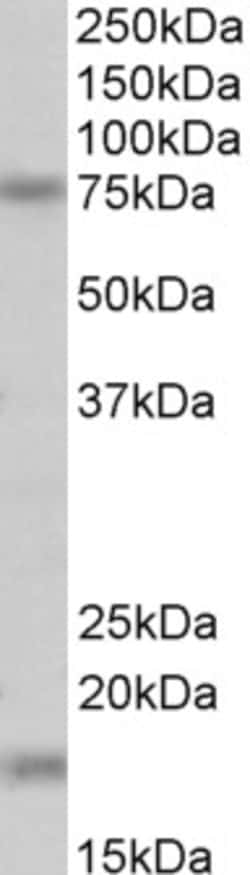 Invitrogen TGM7 Polyclonal Antibody 100 &mu;g; Unconjugated:Antibodies,