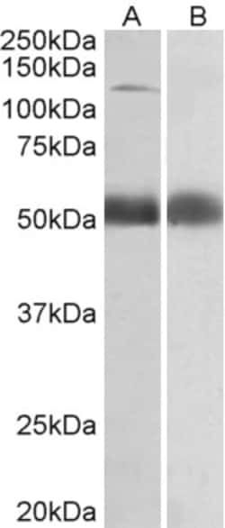 Invitrogen alpha COP Polyclonal Antibody 100 &mu;g; Unconjugated:Antibodies,
