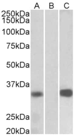 Invitrogen KChIP3 Polyclonal Antibody 100 μg; Unconjugated:Antibodies,