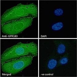 Invitrogen GPR183 Polyclonal Antibody 100 &mu;g; Unconjugated:Antibodies,