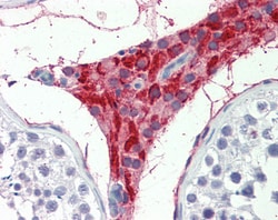 Invitrogen TIAM2 Polyclonal Antibody 100 &mu;g; Unconjugated:Antibodies,