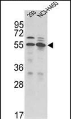 Invitrogen TMPRSS2 Polyclonal Antibody 400 &mu;L; Unconjugated:Antibodies,