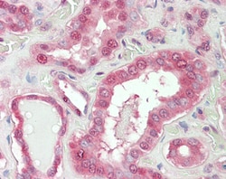 Invitrogen NOX1 Polyclonal Antibody 100 μg; Unconjugated:Antibodies,