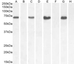 Invitrogen NOX1 Polyclonal Antibody 100 μg; Unconjugated:Antibodies,