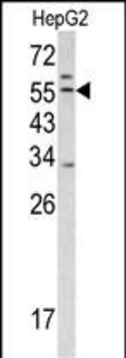 Invitrogen TMPRSS2 Polyclonal Antibody 400 &mu;L; Unconjugated:Antibodies,
