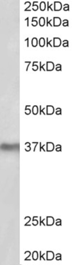 Invitrogen POLDIP2 Polyclonal Antibody 100 &mu;g; Unconjugated:Antibodies,