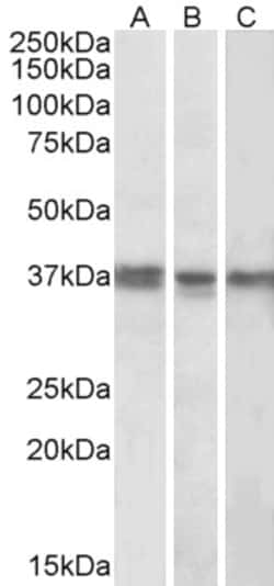 Invitrogen POLDIP2 Polyclonal Antibody 100 &mu;g; Unconjugated:Antibodies,