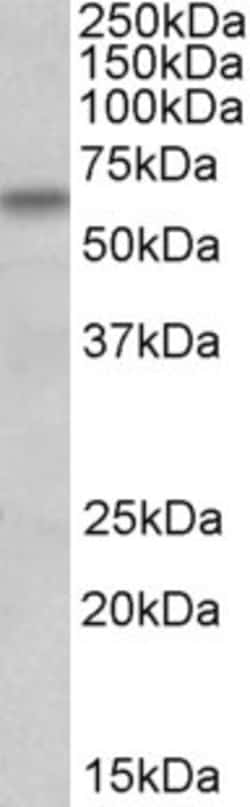 Invitrogen BBS4 Polyclonal Antibody 100 &mu;g; Unconjugated:Antibodies,