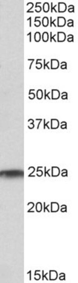 Invitrogen RAN Polyclonal Antibody 100 &mu;g | Buy Online | Invitrogen&trade; | Fisher Scientific