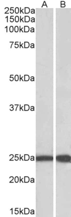 Invitrogen RAN Polyclonal Antibody 100 &mu;g | Buy Online | Invitrogen&trade; | Fisher Scientific