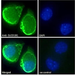 Invitrogen OATP2 Polyclonal Antibody 100 μg; Unconjugated:Antibodies,
