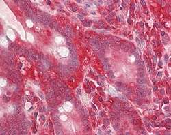 Invitrogen RACK1 Polyclonal Antibody 100 &mu;g; Unconjugated:Antibodies,