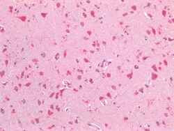 Invitrogen CYB5R3 Polyclonal Antibody 100 &mu;g; Unconjugated:Antibodies,
