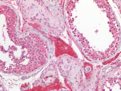 Invitrogen CYB5R3 Polyclonal Antibody 100 &mu;g; Unconjugated:Antibodies,