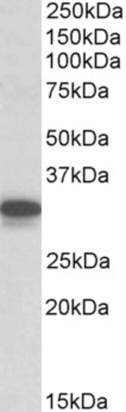 Invitrogen CYB5R3 Polyclonal Antibody 100 &mu;g; Unconjugated:Antibodies,