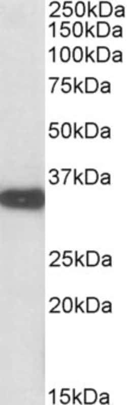 Invitrogen Aspartoacylase Polyclonal Antibody 100 &mu;g | Buy Online | Invitrogen&trade; | Fisher Scientific