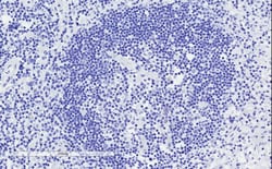 Invitrogen CD28 Polyclonal Antibody 100 μg; Unconjugated:Antibodies,