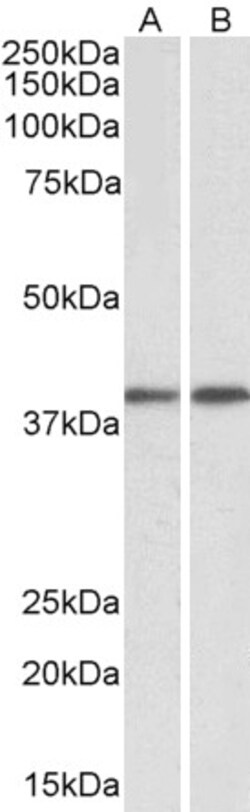 Invitrogen GNAQ Polyclonal Antibody 100 μg; Unconjugated:Antibodies,