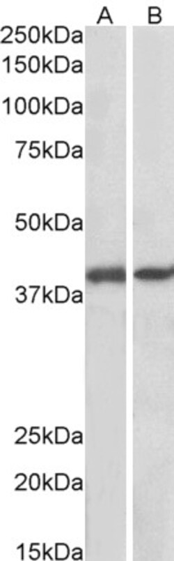 Invitrogen GNAQ Polyclonal Antibody 100 μg; Unconjugated:Antibodies,