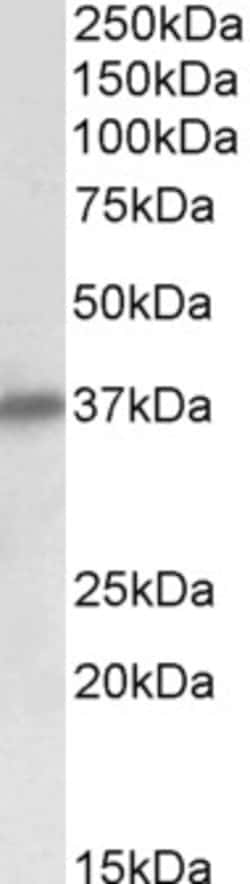 Invitrogen SGCD Polyclonal Antibody 100 &mu;g; Unconjugated:Antibodies,