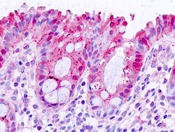 Invitrogen Galectin 3 Polyclonal Antibody 100 &mu;g; Unconjugated:Antibodies,