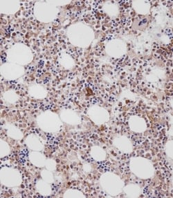 Invitrogen Cathepsin K Polyclonal Antibody 400 &mu;L; Unconjugated:Antibodies,