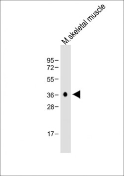 Invitrogen Cathepsin K Polyclonal Antibody 400 &mu;L; Unconjugated:Antibodies,