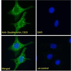 Invitrogen Doublecortin Polyclonal Antibody 100 &mu;g; Unconjugated:Antibodies,
