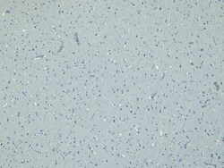 Invitrogen Doublecortin Polyclonal Antibody 100 &mu;g; Unconjugated:Antibodies,